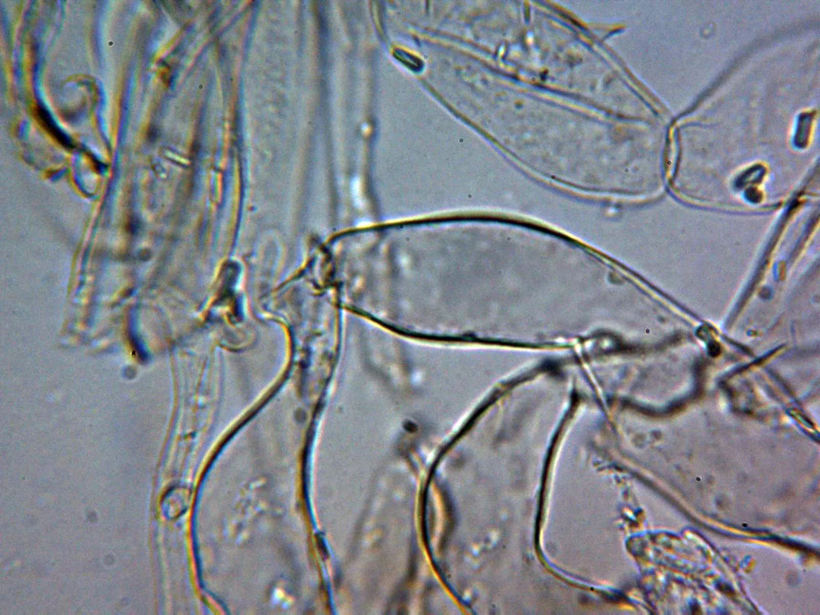 Microscopía de Panaeolus rickenii - 10 - Subpellis 1
